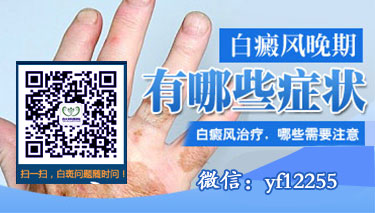 成都博润白癜风医院治白癜风咋样 成都博润白癜风医院治白癜风咋样