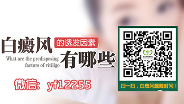 成都博润白癜风专科 成都博润白癜风专科