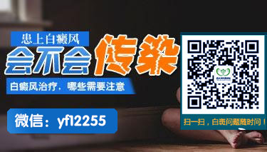 中医治疗白癜风能快速治好白斑吗 中医治疗白癜风能快速治好白斑吗