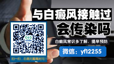 成都治疗白癜风到博润医院 成都治疗白癜风到博润医院