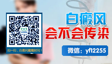 儿童面部白癜风如何治疗效果明显 儿童面部白癜风如何治疗效果明显