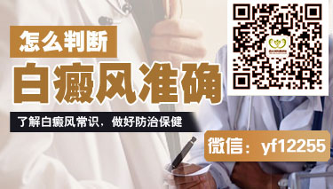治疗白癜风要多长时间才能看到效果 治疗白癜风要多长时间才能看到效果