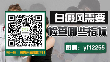 儿童白癜风需要怎么治疗才能好起来呢 儿童白癜风需要怎么治疗才能好起来呢
