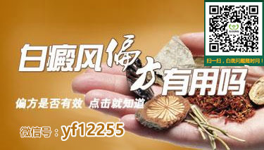 患上白癜风这可怎么办要怎样治疗白癜风 患上白癜风这可怎么办要怎样治疗白癜风