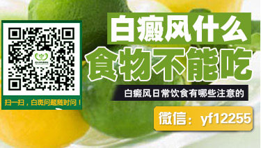 成都博润医院看白癜风怎么样 成都博润医院看白癜风怎么样