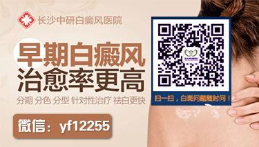 白癜风在治疗的过程中会出现怎样的表现 白癜风在治疗的过程中会出现怎样的表现