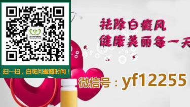 一般来说治白癜风用什么方法较好一些 一般来说治白癜风用什么方法较好一些