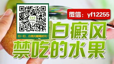 成都博润白癜风医院口碑怎么样 成都博润白癜风医院口碑怎么样