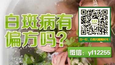 儿童白癜风怎么进行辅助的治疗呢 宝宝全身过敏后出现很多白癜风怎么办